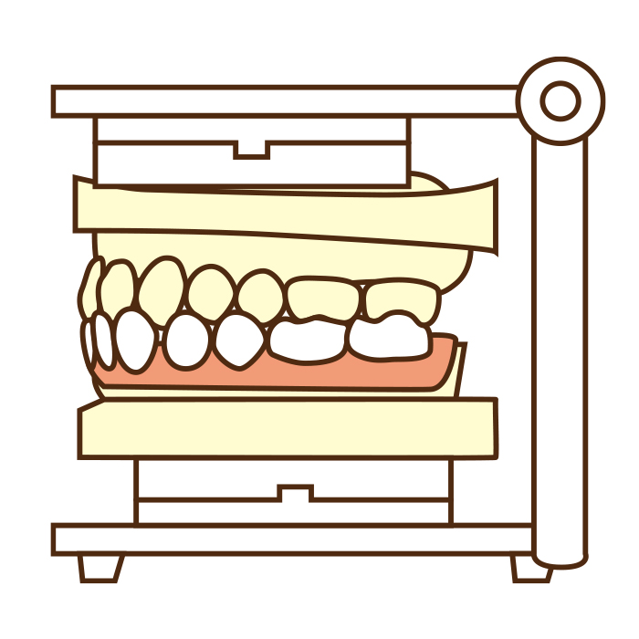 入れ歯の設計