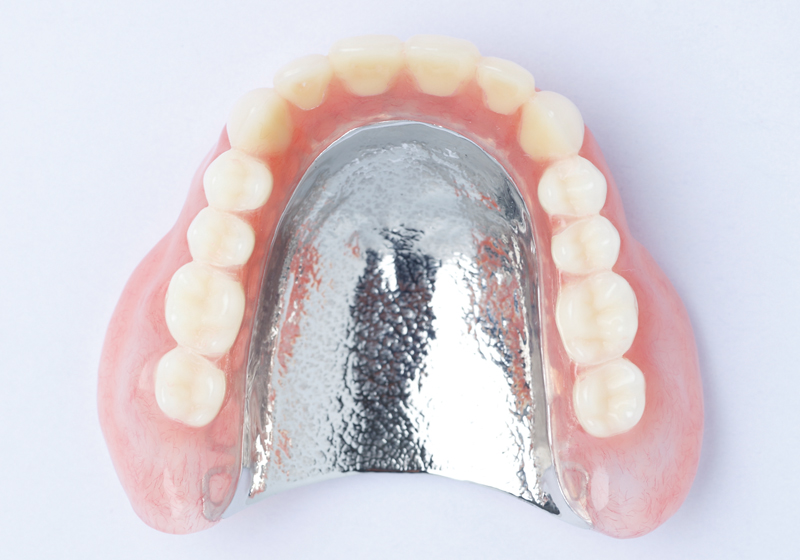 金属床義歯/自費診療